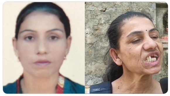 Trabalhadora doméstica do Nepal foi escravizada por 15 anos no Líbano