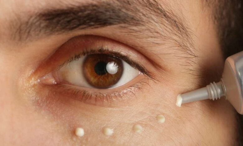 Como disfarçar as olheiras: Dicas práticas para um rosto mais descansado