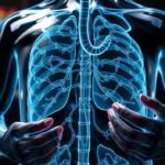 Pancreatite em Usuários de Canetas Emagrecedoras: Causas Investigadas